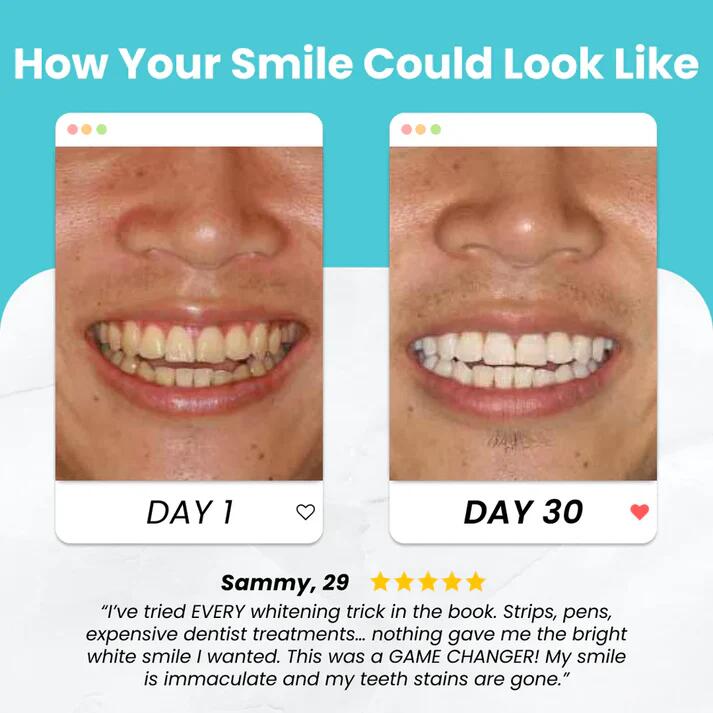 Brushing your teeth has never been simpler---Ubrush